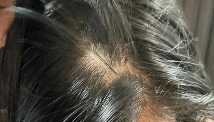 Oknum Polisi di Kolut Diduga Aniaya Istri, Korban Layangkan 2 (Dua) Laporan.